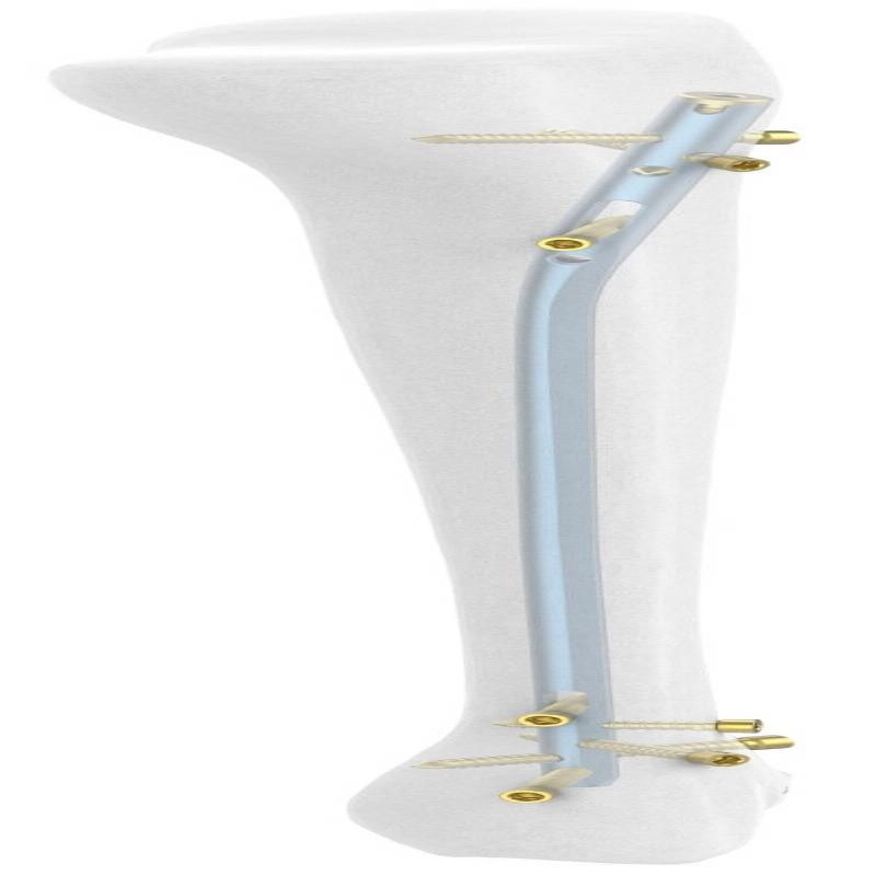 Auxein - Блокуючий гомілковий стрижень